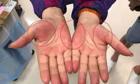 Nếu thường xuyên có 7 cảm giác này, rất có thể nhiều bệnh ung thư đang "thách thức", bạn cần đi khám ngay!