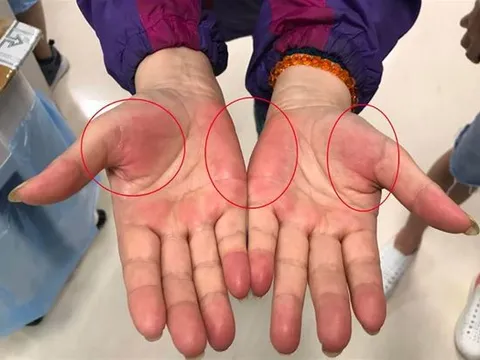 Nếu thường xuyên có 7 cảm giác này, rất có thể nhiều bệnh ung thư đang "thách thức", bạn cần đi khám ngay!