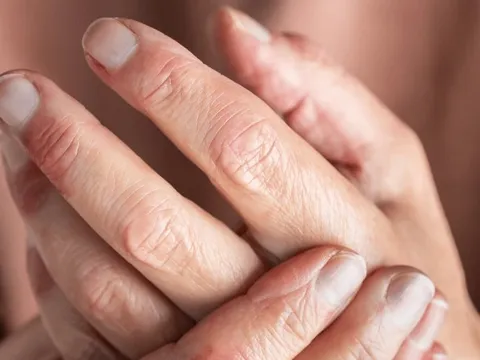 Nhìn tay và chân cũng có thể biết gan bị tổn thương hay không: Đây là 5 dấu hiệu cần lưu ý