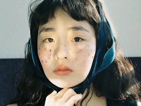 7 vị trí trên cơ thể thường chuyển sang MÀU ĐEN khi ung thư xuất hiện, tự kiểm tra ngay!